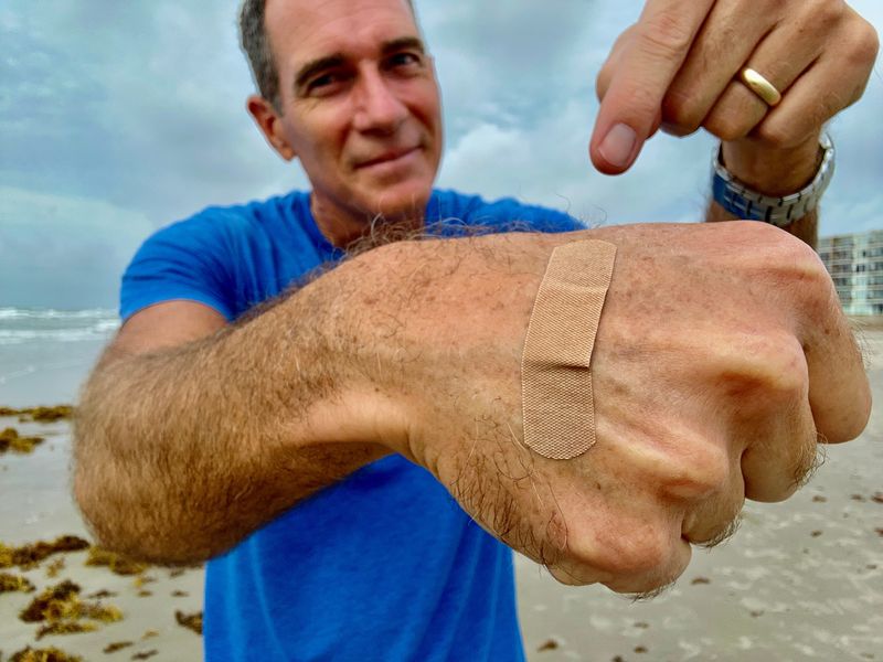 Jace Tunnell holds up his hand with a Band-Aid, showing that he would not go in the water with an open wound to avoid an infection from Vibrio vulnificus, aka the “flesh-eating bacteria.”