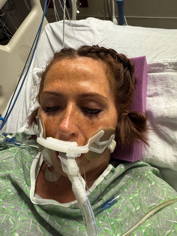 Genevieve Gallagher was hospitalized after contracting vibrio vulnificus bacteria after swimming in Santa Rosa Sound on Pensacola Beach on July 27. She was infected through a small cut on her leg and has since undergone multiple surgeries to save her leg and her life.
