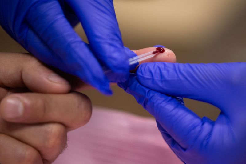 Orlando Narvaez, the Coastal Bend Pride Center's coordinator, uses a pipette to draw 37-year-old's Mitch Moctezuma's blood during an HIV test at the Coastal Bend Wellness Foundation in Corpus Christi, Texas, on June 12, 2025.