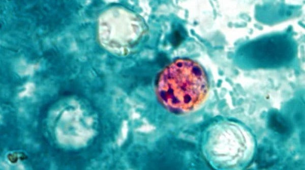 A microscope image shows Cyclospora cayetanensis, the parasite that causes cyclosporiasis, an intestinal illness that can trigger watery or explosive diarrhea.