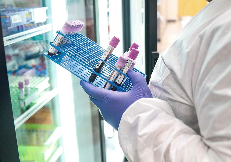 Molecular Laboratory Scientist 'D'onna Robinson holds testing tubes at IU Health Fairbanks Hall, Indianapolis, Wednesday, April 22, 2020.