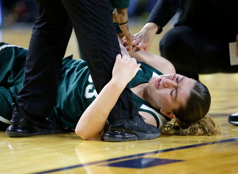 Michigan State forward Juliann Woodard (33) is tended to after taking an elbow to the face, Sunday, Feb. 15, 2026, in Ann Arbor.