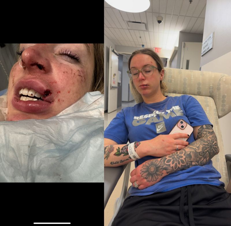 Celia Haueter after she was assaulted by a man outside MGM Grand while security allegedly watched.