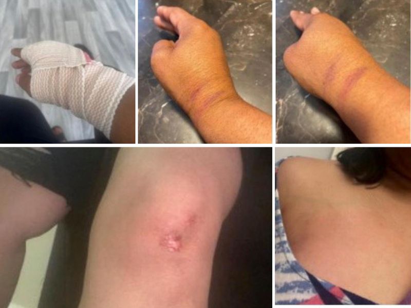 Tonia O'Neil of Detroit said she suffered injuries from Detroit police officers during an August 2025 incident outside her family's west-side barbershop, according to a federal lawsuit filed on her behalf.