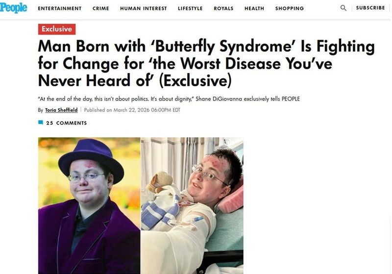 Cincinnati resident Shane DiGiovanna, who advocates for patients with his skin condition, is featured in People magazine.