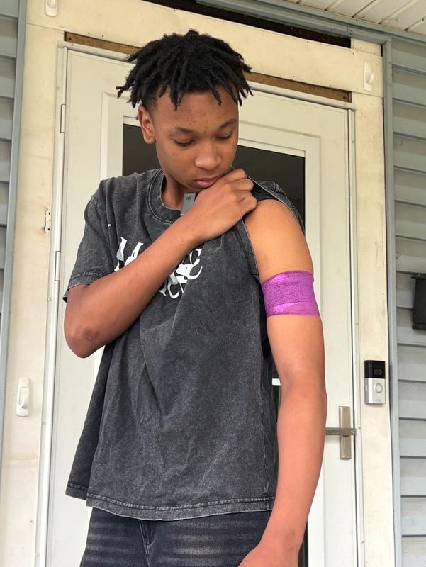 Christian Webb looks at his left arm, where a bullet remains after he was hit by a stray gunshot fired on the afternoon of May 21. May 22, 2026